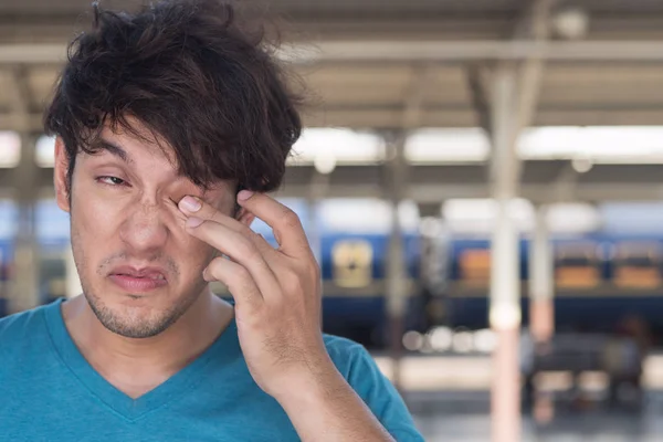 Hombre Adulto Joven Enfermo Que Sufre Ojo Seco Irritación Inflamación —  Fotos de Stock