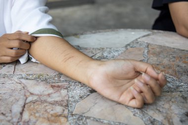 Kolunda yara izi olan bir Igbt kadınına zorbalık yapıldı.