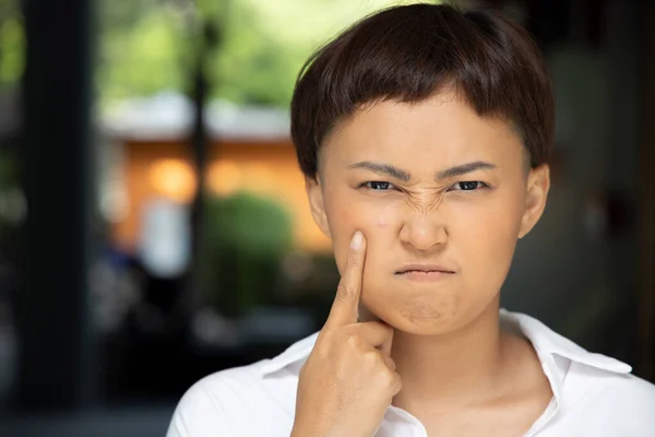 Ongelukkige Vrouw Met Acne Haar Wang Gezicht Concept Van Gezichtsverzorging — Stockfoto