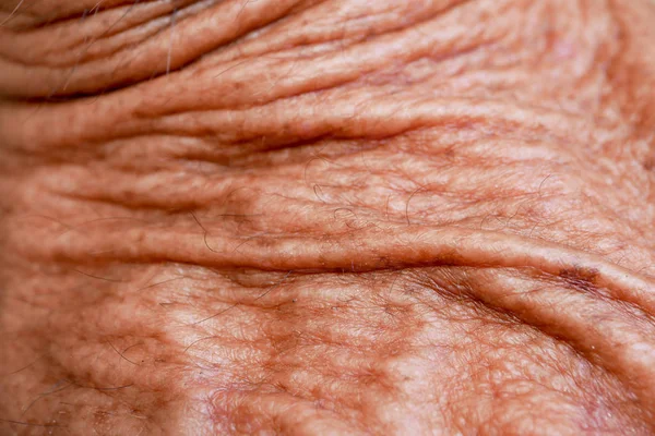 Abstrato fundo textura velho homem pele — Fotografia de Stock