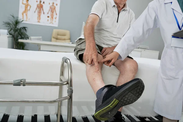 男性患者の示す彼の足にあざを行う医師します — ストック写真