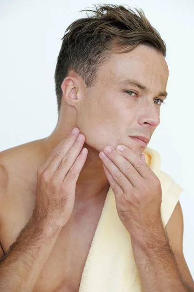 Jongeman Ongelukkig Met Onvolkomenheden Van Zijn Huid — Stockfoto