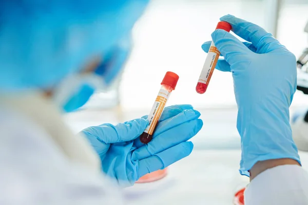 doctor wearing rubber gloves and white coat holding blood test tubes in hands