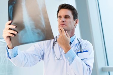 Dalgın pratisyen x-ray kaburga kafesi analiz