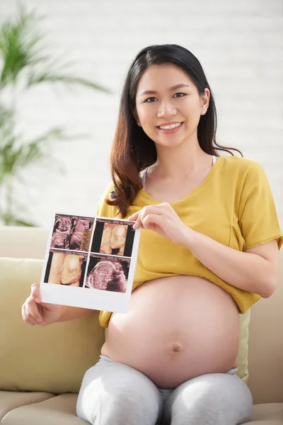 Mulher Grávida Muito Sorridente Mostrando Ultra Som Foto Seu Bebê — Fotografia de Stock
