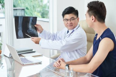 Tıbbi giyim bacaklar x-ışını fotoğrafı için genç adam masada otururken gösteren Asyalı doktor