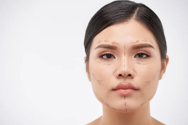 Face Beautiful Young Vietnamese Woman Lines Upcoming Surgery — Stock Photo, Image