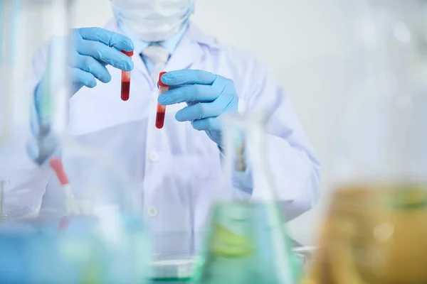 技术人员在实验室研究中 用防护手套盛放血瓶的特写镜头 — 图库照片