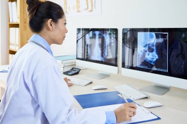 Lab coat'da ciddi Asyalı doktor işyerinde oturuyor ve bilgisayarlarda x-ray taramaları inceleyerek monitörler ve belge kusurları yazma