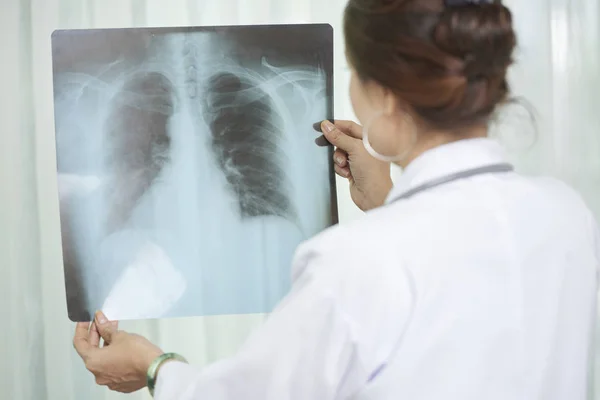 Hastanın Göğüs Röntgenini Kontrol Kadın Akciğer Uzmanının Arka Görünümü — Stok fotoğraf