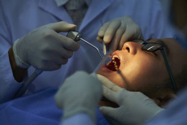 Doktor ve hemşire dişlerini diş hekiminde özel aletlerle tedavi ederken genç adam ağzı açık yatıyor.