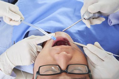 Gözlüklü genç adam ağzını açıp yalan söylüyor ve dişleri için stomatoloji kliniğinde tıbbi bir prosedür uyguluyor.