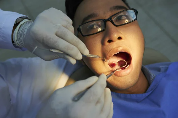 歯科医が診療所で治療する前に歯科用具で歯を調べている間 眼鏡をかけたアジアの若者が口を開いて横たわっている — ストック写真