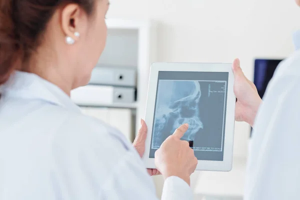 神経科医と放射線科医が医療オフィスのタブレットコンピュータ上で患者のスカルX線を議論 — ストック写真
