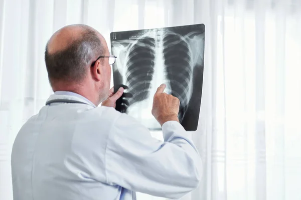 Radioloog Onderzoekt Longen Ray Van Patiënt Het Zoeken Naar Tekenen — Stockfoto