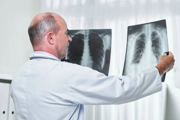 Médico Geral Comparando Duas Radiografias Tórax Paciente Com Pneumonia — Fotografia de Stock