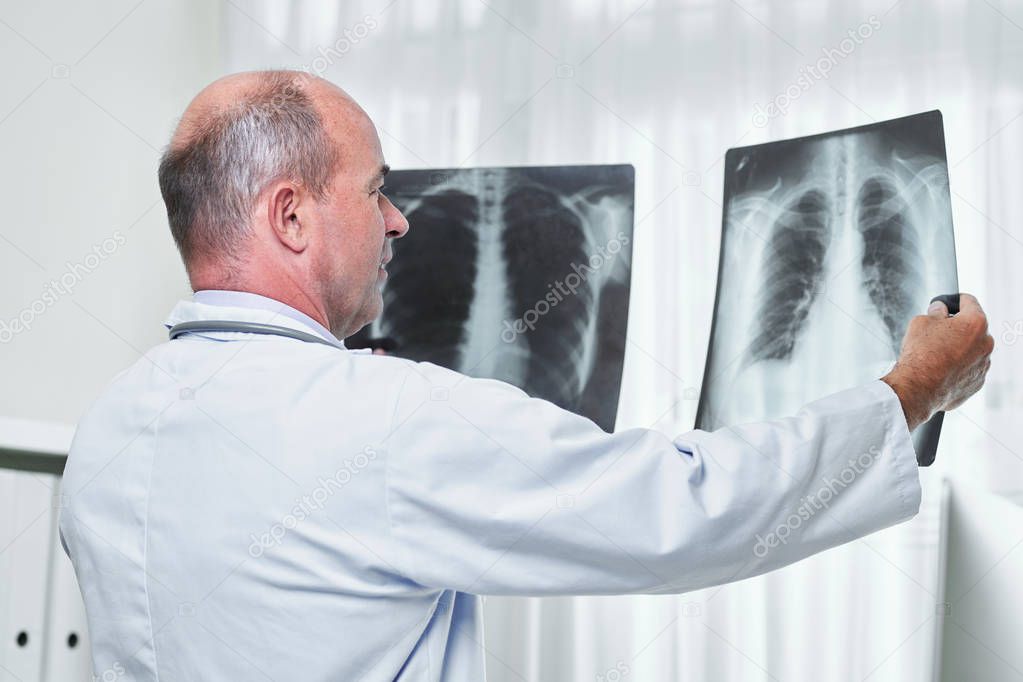 General practitioner comparing two chest x-rays of patient with pneumonia