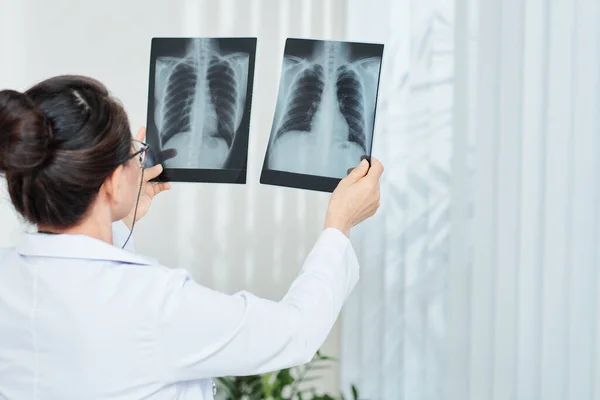 Plicní Lékař Kontroluje Rentgen Pacienta Pneumonií Pohled Zezadu — Stock fotografie
