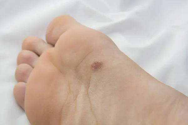 skin.close kadar sorun alanları ile ayak