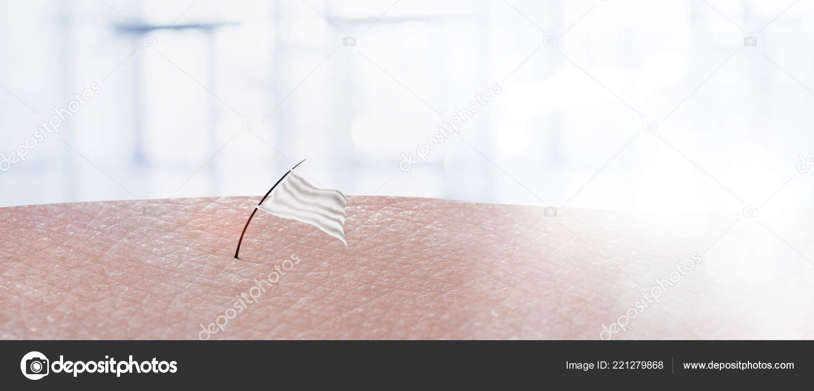 Cosmetology Procedure Hair Removal Body Parts Surrender Hair
