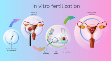 İn vitro fertilizasyon yordamlar vektör düzeninde