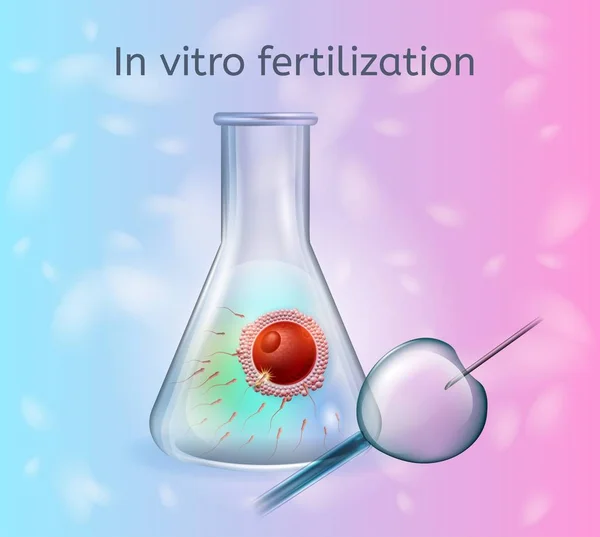 Conceito de vetor de processo de fertilização in vitro —  Vetores de Stock