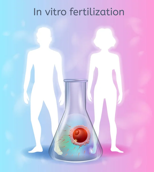 V in Vitro fertilizace realistická vektorová koncept — Stockový vektor