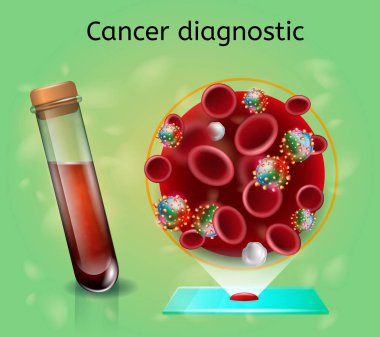 Hematolojik araştırma erken kanser tanısı için