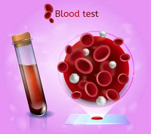 Análisis de sangre de laboratorio Concepto vectorial realista — Vector de stock