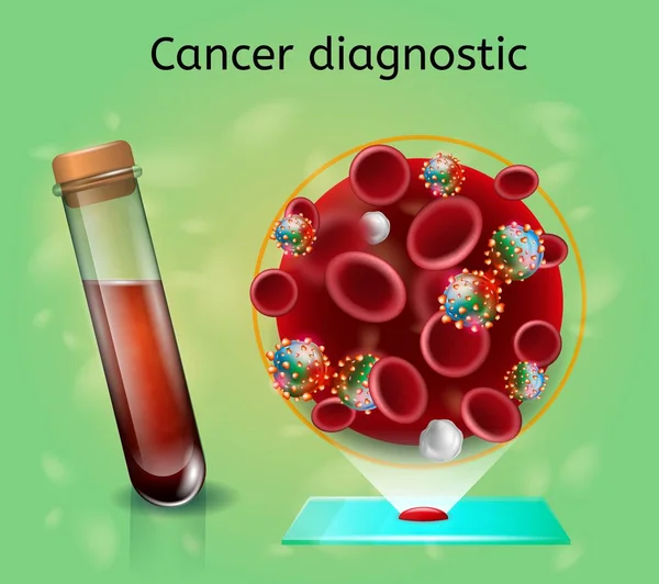 Investigación hematológica para el diagnóstico precoz del cáncer — Vector de stock