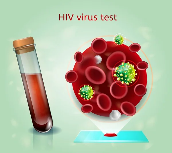Konsep Vektor Realistik Tes Darah Virus HIV - Stok Vektor