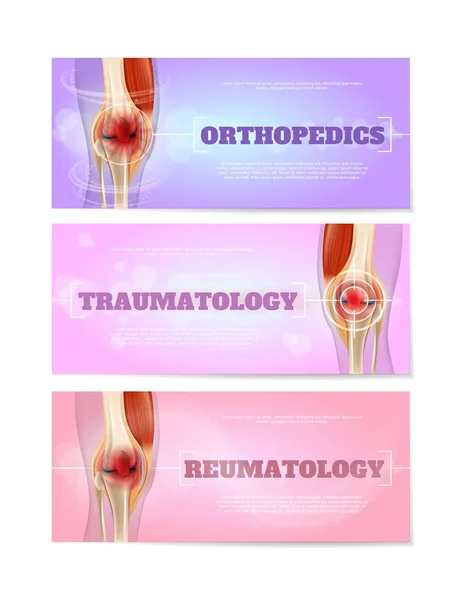 Medizinische Web-Banner mit Kniegelenkvektor-Set — Stockvektor