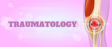 Gerçekçi illüstrasyon Rraumatologe tıp 3D