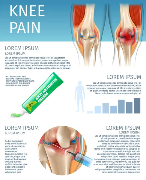 Banner Infographics knä smärta behandlingsmetoder — Stock vektor