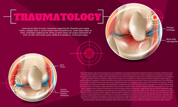 Realistisk Illustration traumatologi medicin i 3d — Stock vektor