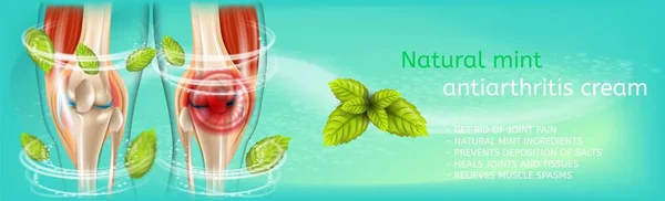 Vector Banner Natural Mint Antiarthritis Cream Realistic Illustration Anatomy Human — Stock Vector