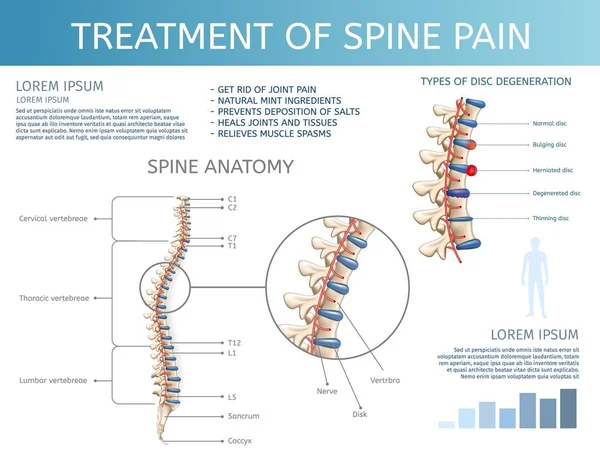 Pengobatan vektor Spine Pain. Anatomi tulang belakang . - Stok Vektor