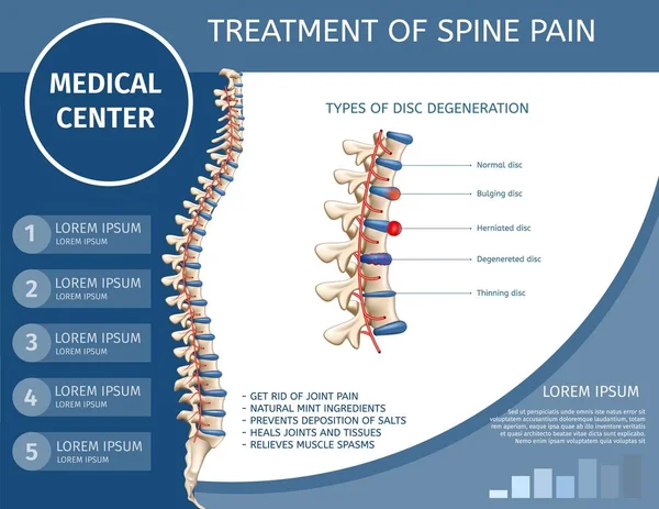 Tratamiento del dolor de columna Banner plano médico . — Vector de stock