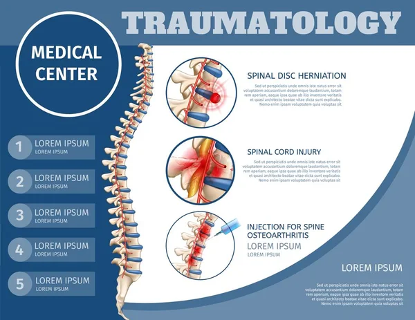 Plano cuadrado Banner Traumatología Centro Médico . — Archivo Imágenes Vectoriales