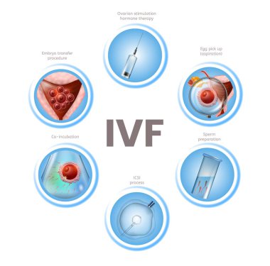 In Vitro Fertilization Infographics Round Icons clipart
