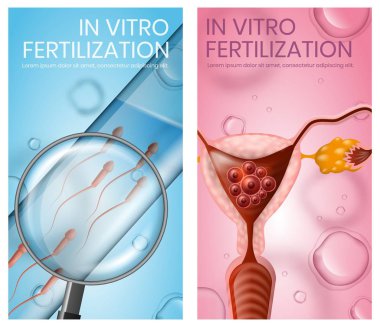Spermle Implante embriyo test tüpü ile uterusu