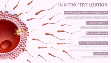 Üreme hekimliği. In vitro fertilizasyon