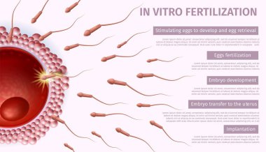 Reproductive Medicine. In Vitro Fertilization clipart