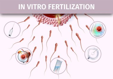 Suni Insemination Infographic yardım Banner