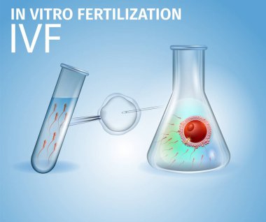 Methods of Infertility Treatment, IVF, Egg, Sperm clipart