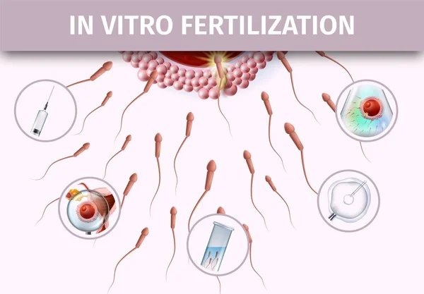 Banner de ayuda infográfica para inseminación artificial — Vector de stock