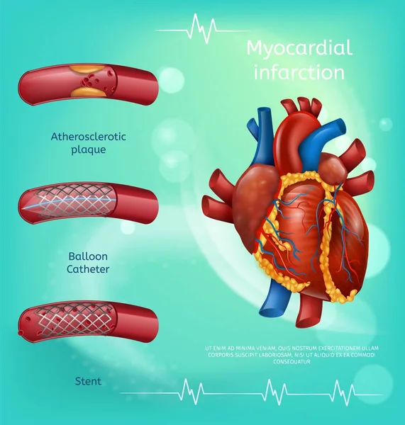 Imagen de la bandera Recipientes de sangre realistas Corazón humano — Vector de stock