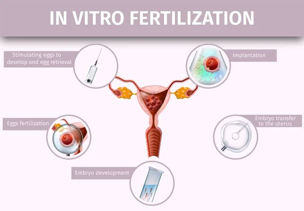 In Vitro Fertilization and Ovulation Background, — Stock Vector