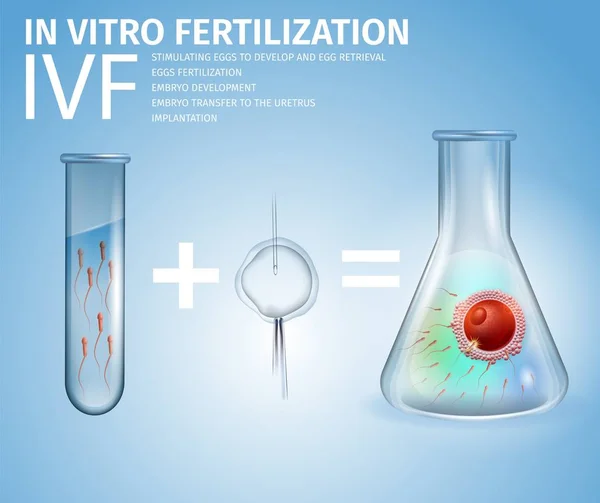 Fórmula de Fertilização In Vitro e Fases Banner —  Vetores de Stock