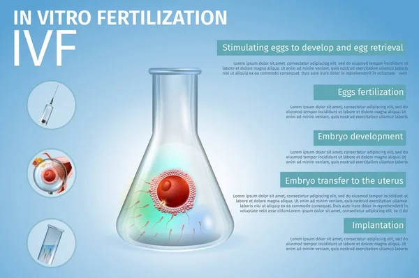 Composição do processo das fases da fertilização in vitro . —  Vetores de Stock